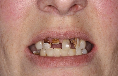 Smile gallary image - Before